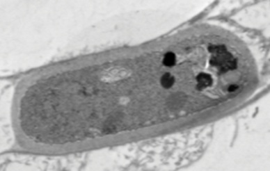 fungal pathogen